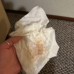 This is me dabbing my carpet after they left and pulling up stains. This is me dabbing my carpet after they left and pulling up stains.