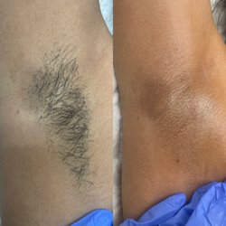 #underarmwax