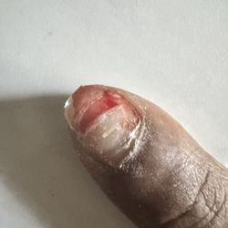 Pristine Nails - My nail was destroyed