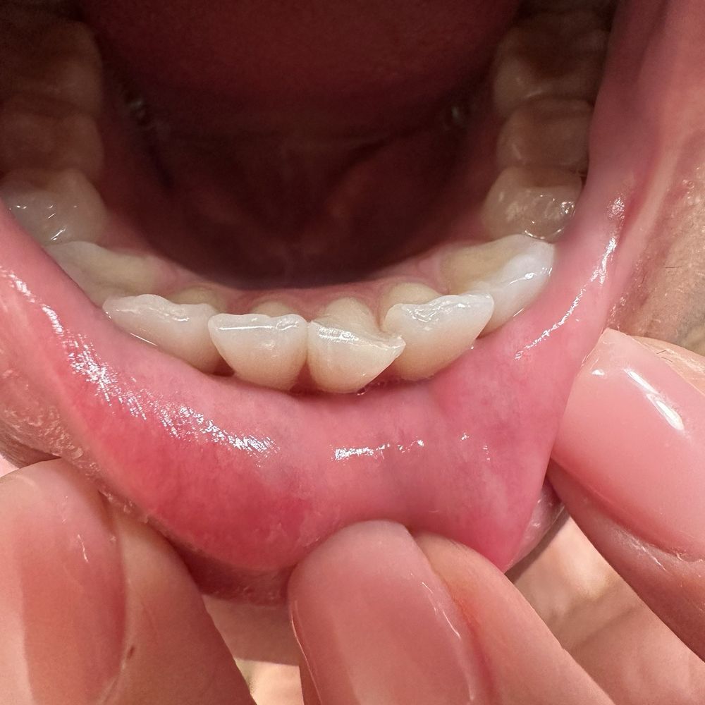 Aspen Dental - Phoenix, AZ - Arcadia - Made my tooth appear VERT CROOKED WHEN IN FACT IT WAS NOT - Oral Surgeons Near Me - Phoenix, Arizona Aspen Dental - Phoenix, AZ - Arcadia - Made my tooth appear VERT CROOKED WHEN IN FACT IT WAS NOT - Oral Surgeons Near Me - Phoenix, Arizona