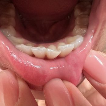 Aspen Dental - Phoenix, AZ - Arcadia - Made my tooth appear VERT CROOKED WHEN IN FACT IT WAS NOT - Oral Surgeons Near Me - Phoenix, Arizona