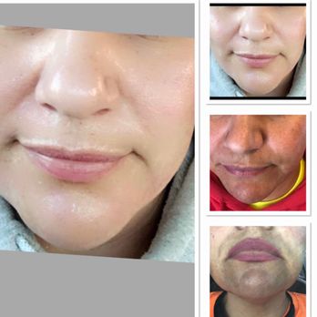 Peachy Skin Care - Medical Spas Near Me - Davis, California Peachy Skin Care - Medical Spas Near Me - Davis, California