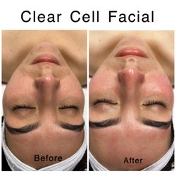 Beauty Upgrade - Facial