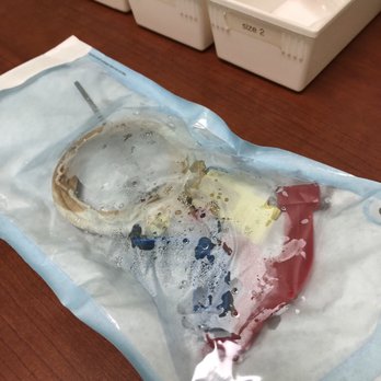 Aspen Dental - Orlando, FL - Waterford Lakes - Nope!  That's not going near my mouth! - Oral Surgeons Near Me - Orlando, Florida