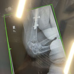All Florida Orthopaedic Associates