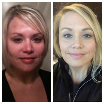 The Skin Studio - Wow! Look at the difference Osmosis home care has made in her skin! So excited with her results. - Skin Care Near Me - Brentwood, Tennessee The Skin Studio - Wow! Look at the difference Osmosis home care has made in her skin! So excited with her results. - Skin Care Near Me - Brentwood, Tennessee
