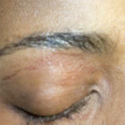 Nail Illusions - Please be careful while getting your eyebrows waxed. Both eyelids are burned.