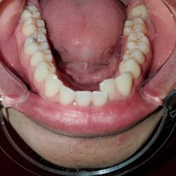Szymanowski Orthodontics - Before