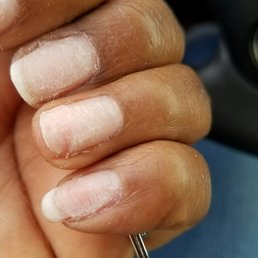 I ask for them to take off gel and they filed off my ring finger nail... so upset. I ask for them to take off gel and they filed off my ring finger nail... so upset.