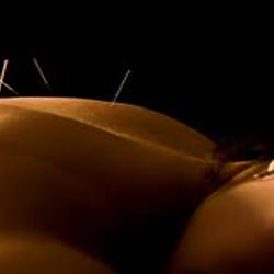 Oasis Acupuncture & Fertility - Try our uniquely Customized and Restorative Acupuncture treatments. Relaxation and Rejuvenation is our speciality here at Oasis!