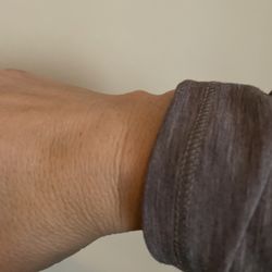 midwest hand surgery