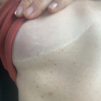 Lanoi Dermatology - Before Dr. Rudy - Dermatologists Near Me - San Diego, California Lanoi Dermatology - Before Dr. Rudy - Dermatologists Near Me - San Diego, California