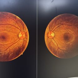 Midway Optometry - Eye exam