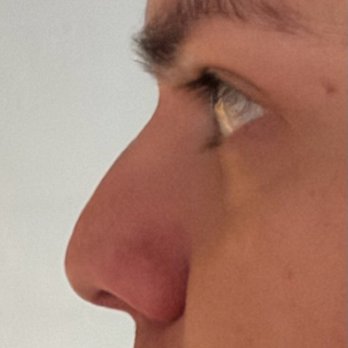 Alexis Furze, MD - Ear Nose & Throat Near Me - Newport Beach, California