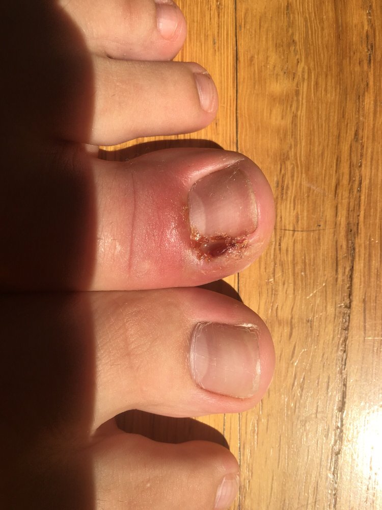 ANKLE & FOOT CENTERS OF 4385 Johns Creek Pkwy, Suwannee