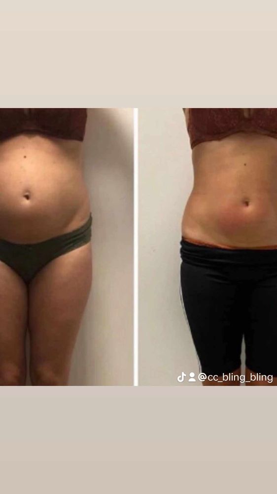 TRIM AND SLIM DAY SPA AND BODY SCULPTING Updated May 2024 12 Photos