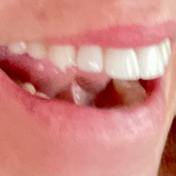 Alora Dentistry - Good job - Pediatric Dentists Near Me - Napa, California Alora Dentistry - Good job - Pediatric Dentists Near Me - Napa, California