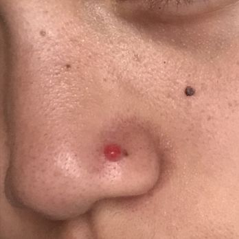 Big Daddy's Tattoo - bump which formed from my improperly angled nose piercing ): had to remove the stud - Tattoo Near Me - Harbor City, California