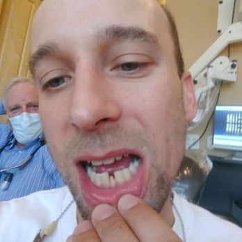 James Williamson, Dmd - Getting my tooth fixed by a badass! - General Dentistry Near Me - Salt Lake City, Utah James Williamson, Dmd - Getting my tooth fixed by a badass! - General Dentistry Near Me - Salt Lake City, Utah