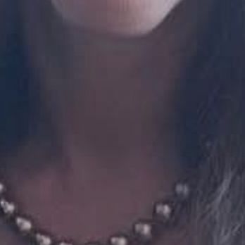 James Newman, MD - Premier Plastic Surgery - End result. Natural - Plastic Surgeons Near Me - San Mateo, California
