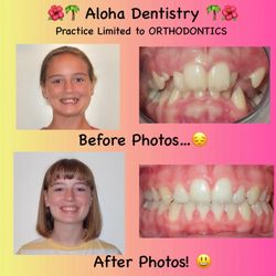 Bruce Gloeckner, DDS - Aloha Dentistry - You look simply beautiful! Thank you Braun Family!