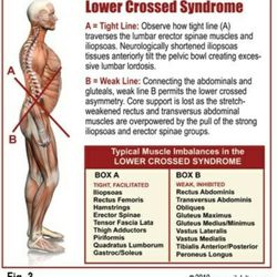 Integrity Massage - A root cause of Sciatica