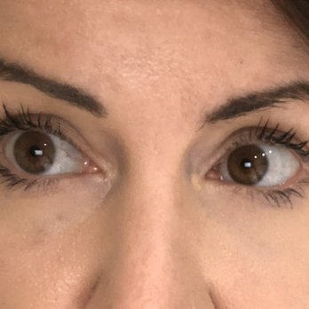 Plump Cosmetics & Injectables - So far so good day one. - Medical Spas Near Me - New York, New York Plump Cosmetics & Injectables - So far so good day one. - Medical Spas Near Me - New York, New York