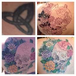 Before, during, and after it's all healed :) Before, during, and after it's all healed :)