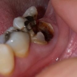 Ohio Urgent Dental