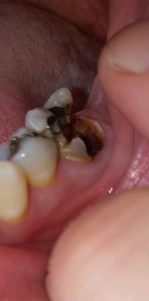 Ohio Urgent Dental - patient advocate in Grove City, OH