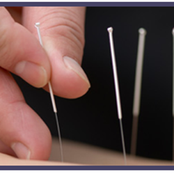 Maui Acupuncture