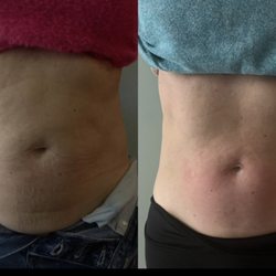 Goodbye Bodyfat