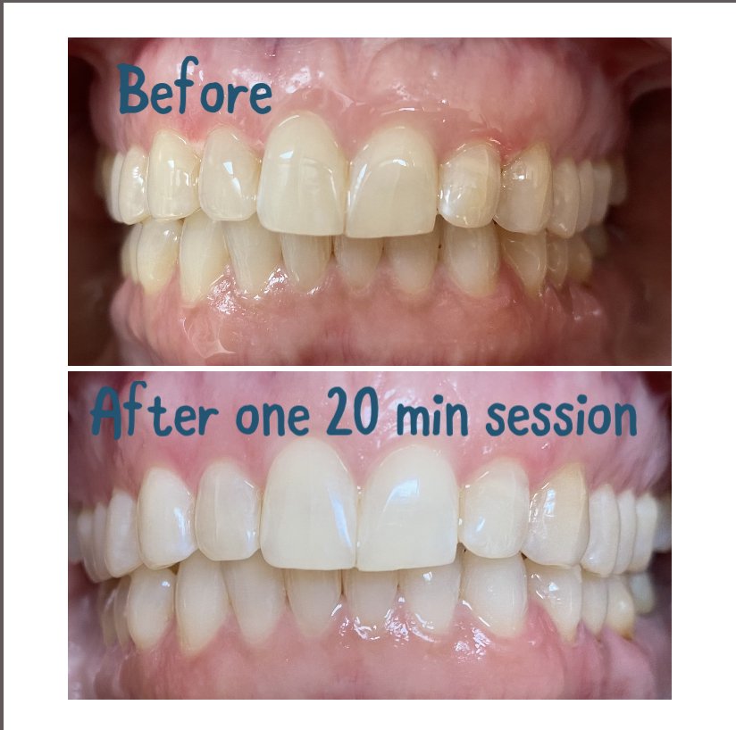 White Teeth Fast Logo