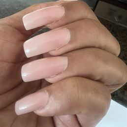 Lifting middle nail 4 days later Lifting middle nail 4 days later