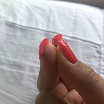 Victory Nails & Spa - Cut my finger twice. Kept bleeding, and the manicurist brushed it off. - Nail Salons Near Me - Fullerton, California Victory Nails & Spa - Cut my finger twice. Kept bleeding, and the manicurist brushed it off. - Nail Salons Near Me - Fullerton, California