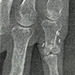 See how joint is different than the others