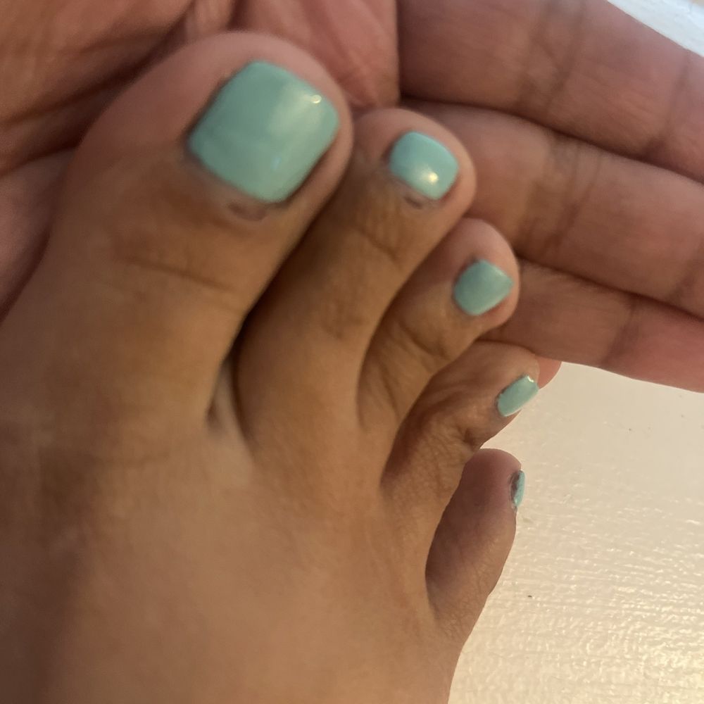 It still hurts and I forgot to mention the nail tech sprayed it also with alcohol at the end of the pedicure too