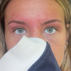Neo Brows - Uneven eyebrows