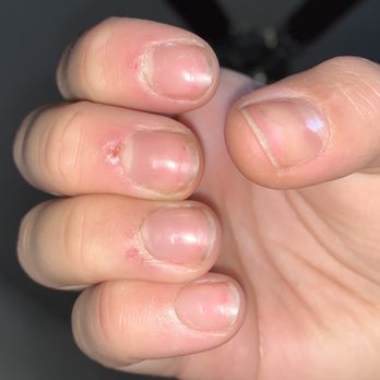 Friendly Nails & Spa - Peeling cuticles (tender to the touch) - Nail Salons Near Me - Sparks, Nevada Friendly Nails & Spa - Peeling cuticles (tender to the touch) - Nail Salons Near Me - Sparks, Nevada
