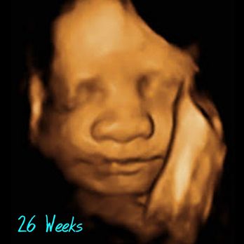 First Glimpse Imaging - Diagnostic Imaging Near Me - Austin, Texas First Glimpse Imaging - Diagnostic Imaging Near Me - Austin, Texas