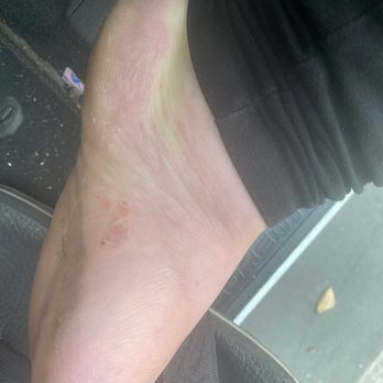 Spectrum Nail Spa - This is after two weeks of a prescribed fungal Medication! So gross!!! - Nail Salons Near Me - Elk Grove, California Spectrum Nail Spa - This is after two weeks of a prescribed fungal Medication! So gross!!! - Nail Salons Near Me - Elk Grove, California