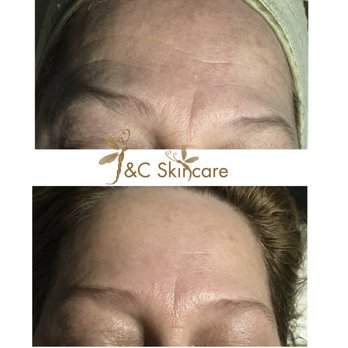 J&C Skincare - One treatment - from fine lines to pigmentations! - Skin Care Near Me - Tewksbury, Massachusetts J&C Skincare - One treatment - from fine lines to pigmentations! - Skin Care Near Me - Tewksbury, Massachusetts