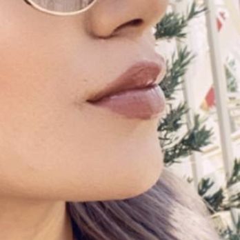 Luxsy Xthetics - Teeth Whitening Near Me - Las Vegas, Nevada Luxsy Xthetics - Teeth Whitening Near Me - Las Vegas, Nevada
