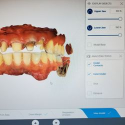 Rojas Family Dentistry - Digital technology for the comfort of our patients.