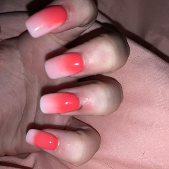 Top Nails - The first finger is where she took my cuticle off too far down and the third finger is where she cut me multiple times with the drill. - Nail Salons Near Me - Columbus, Indiana Top Nails - The first finger is where she took my cuticle off too far down and the third finger is where she cut me multiple times with the drill. - Nail Salons Near Me - Columbus, Indiana