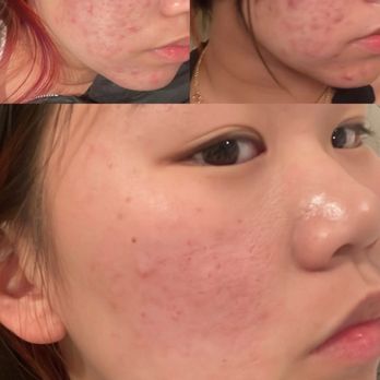 Endless Beauty Health - Skin Care Near Me - Alhambra, California Endless Beauty Health - Skin Care Near Me - Alhambra, California