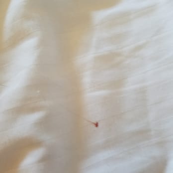 Ameristar Black Hawk - Blood on sheets and not our blood!!! - Casinos Near Me - Black Hawk, Colorado
