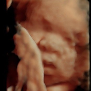 Urgent Diagnostic Imaging Center - My boy at 33 weeks - Diagnostic Imaging Near Me - Glendale, California Urgent Diagnostic Imaging Center - My boy at 33 weeks - Diagnostic Imaging Near Me - Glendale, California