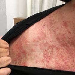 Integrative Care and Allergy Center