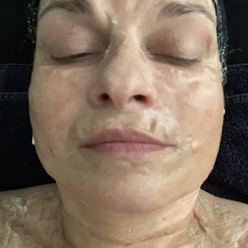 Shameless Aesthetics - Treatment - Skin Care Near Me - Cumming, Georgia